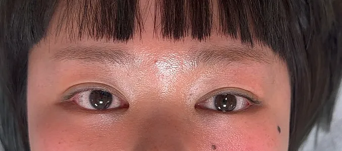 アイラインアートメイク 施術前