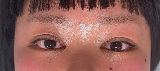 アイラインアートメイク 施術後