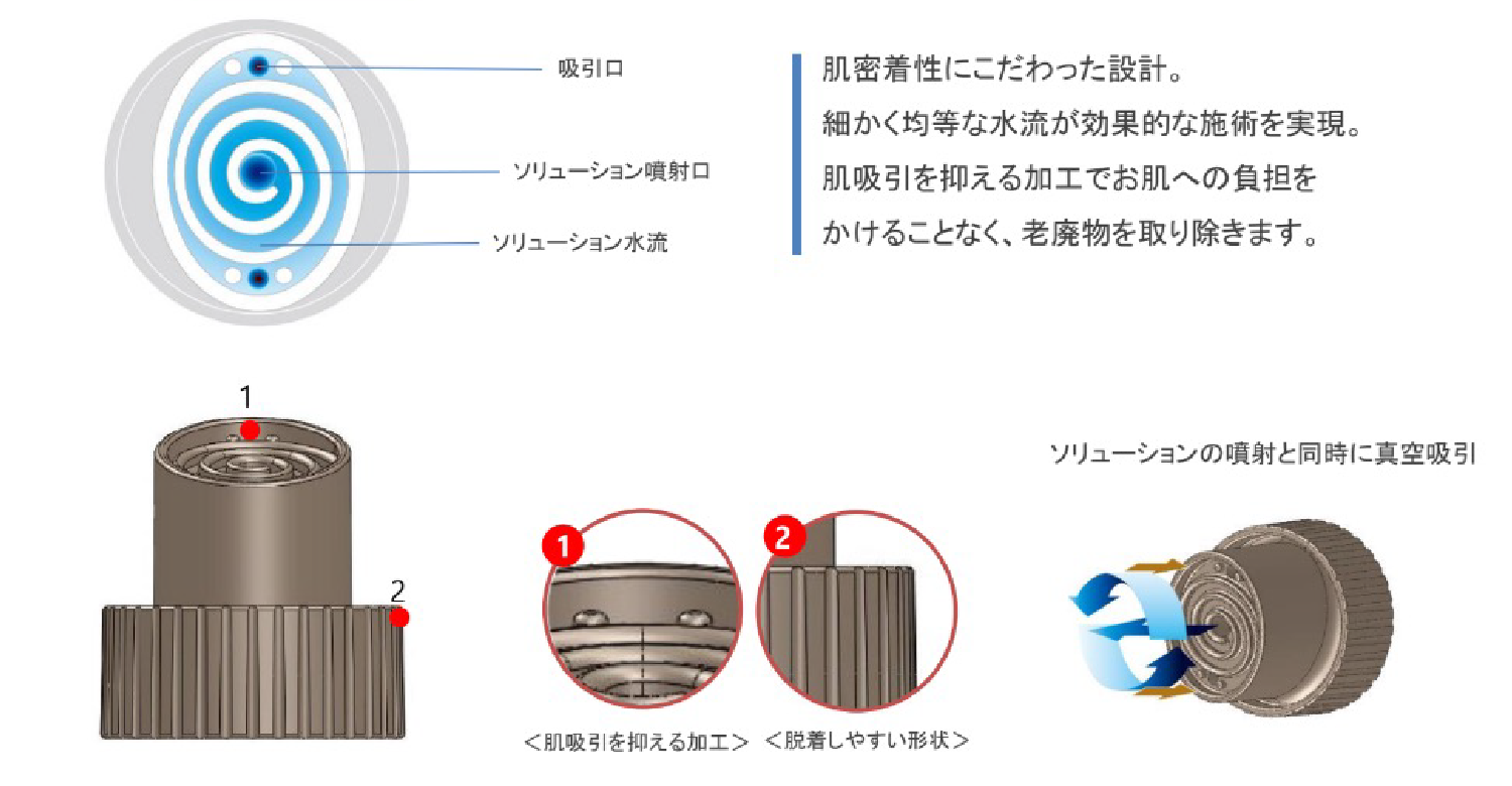 螺旋型チップ