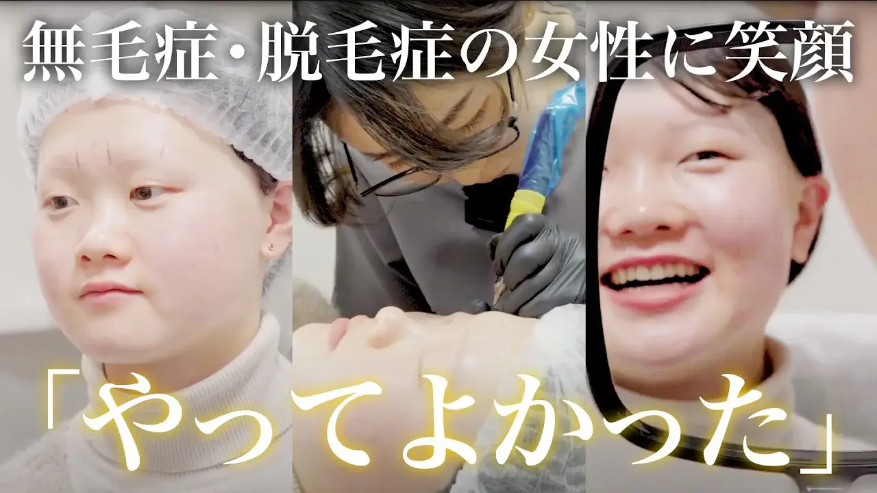 無毛症・脱毛症の女性に笑顔「やってよかった」