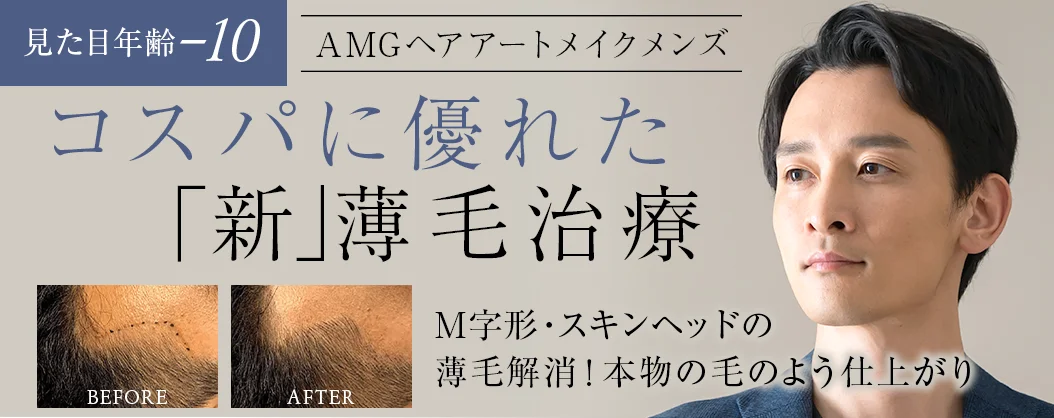 コスパに優れた「新」薄毛治療 メンズ ヘアラインアートメイク