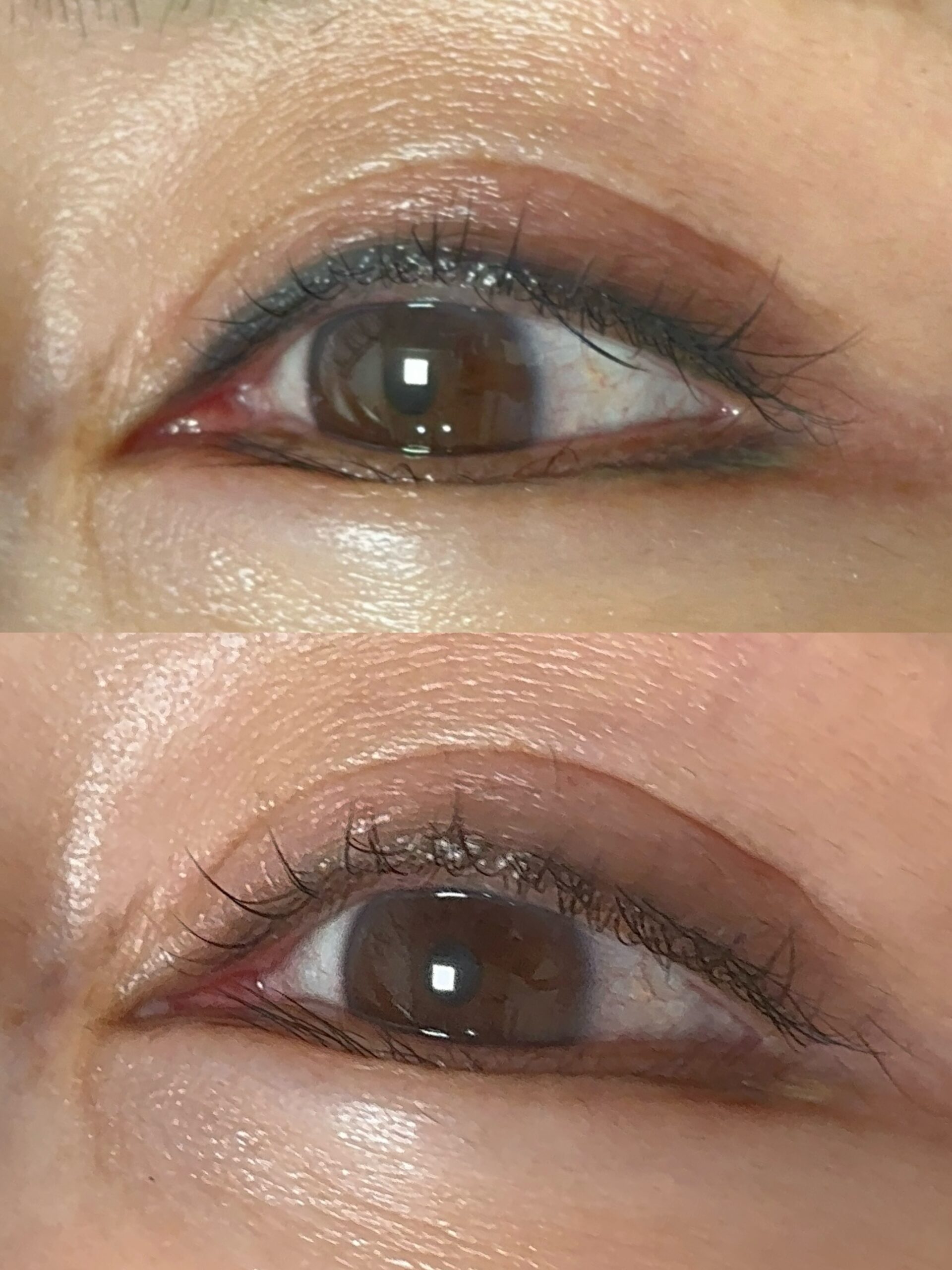 症例ギャラリー - アートメイクギャラリー【公式】東京銀座・大阪梅田